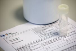 Probenbehälter und Prüfantrag für Behandlungseinheiten